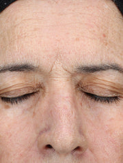 Close up of face before using product